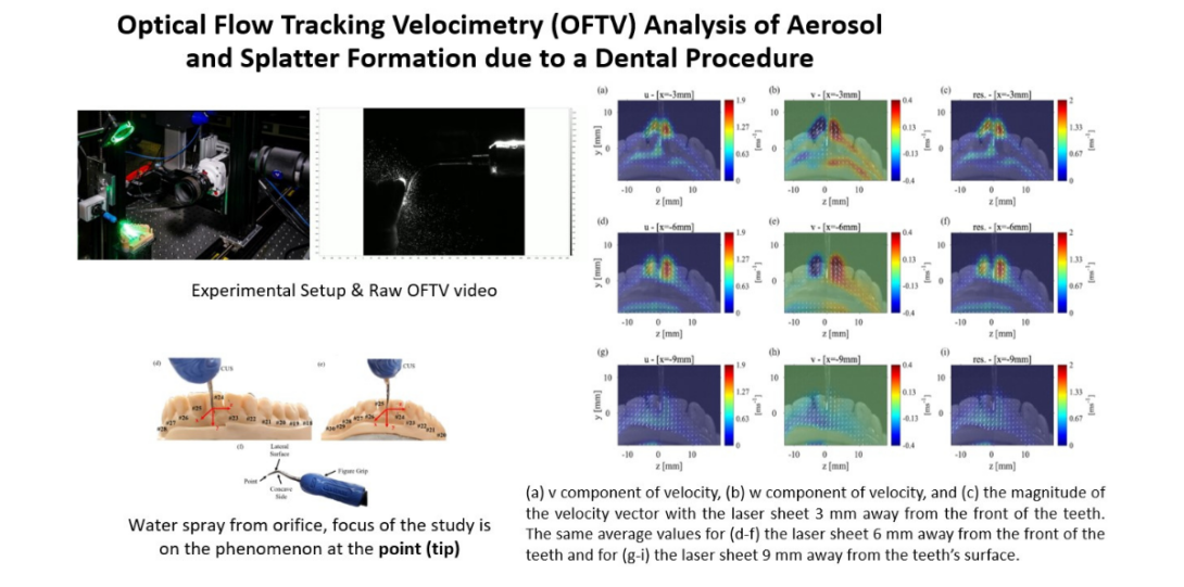 OFTV Analysis of Aerosol and Splatter Formation